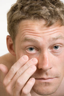 konjuktivitis, iritacija očiju, crvene oči, crveno oko