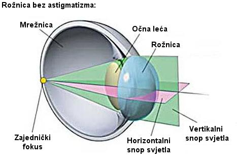 astigmatizam, korekcija astigmatizma, simptomi astigmatizma, pravilni astigmatizam