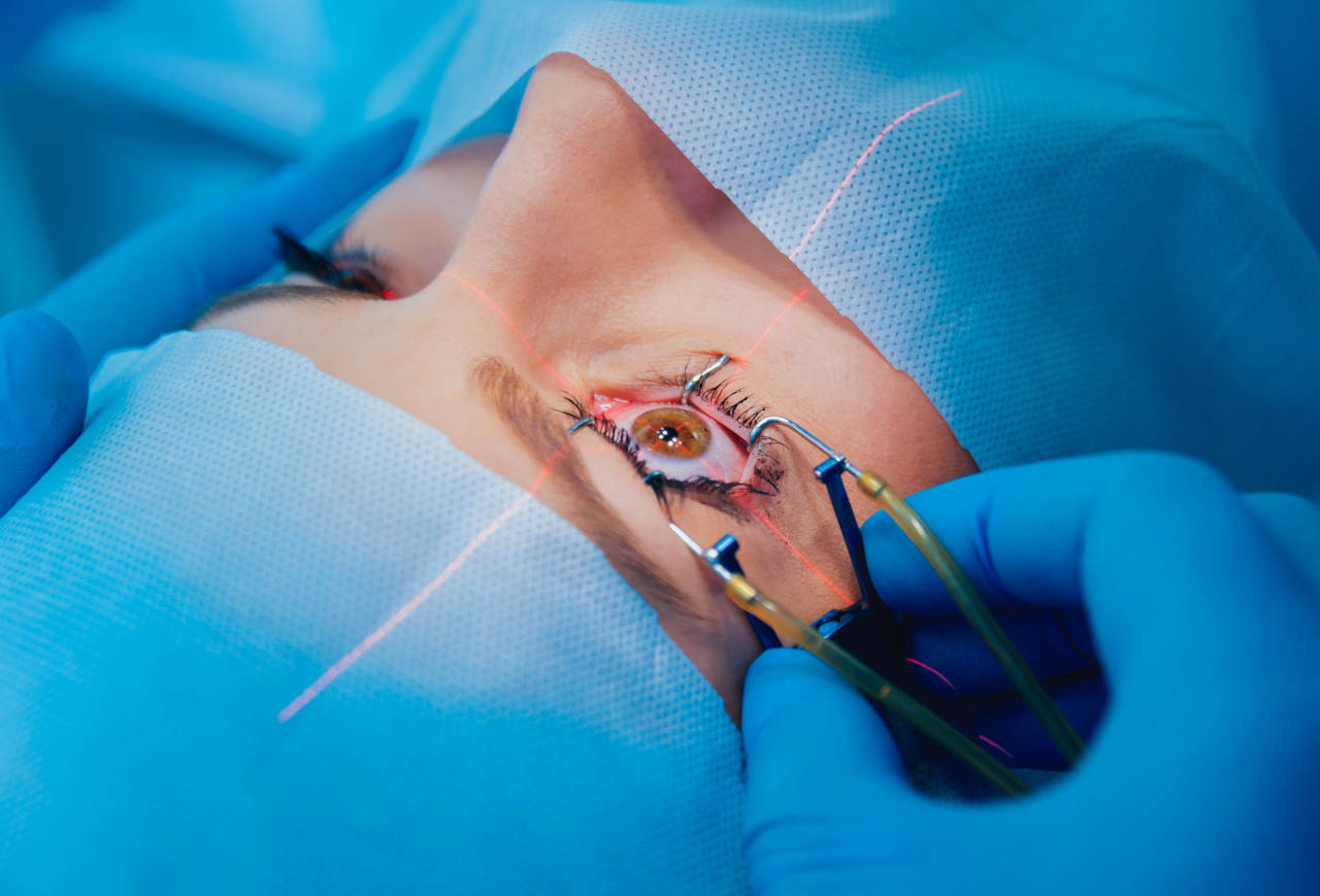 Laserska operacija oka, laserska operacija vida