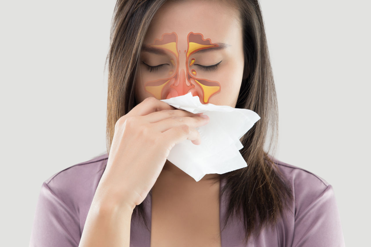 bol u očima sinusitis