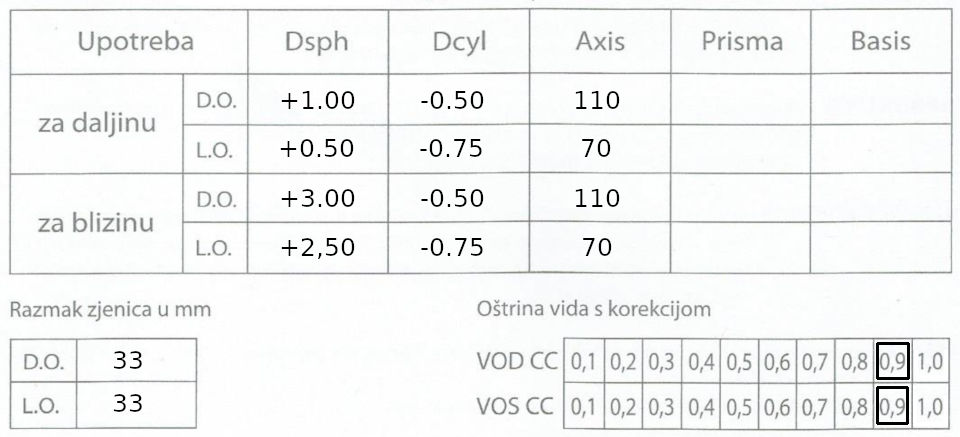 Oftalmološki nalaz dioptrija dalekovidnost, astigmatizam, presbiopija