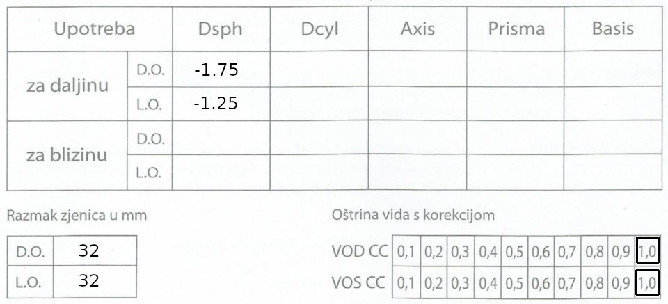 oftalmološki nalaz dioptrija minus