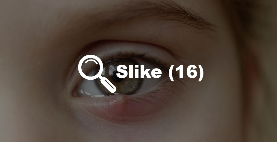 Ječmenac slike