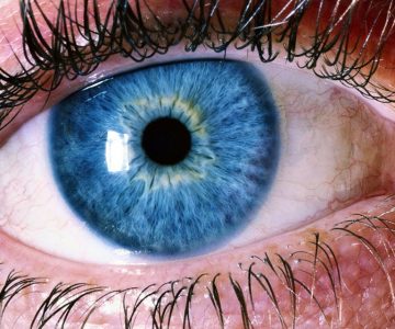 Ablacija retine ili mrežnice – simptomi, uzroci i liječenje