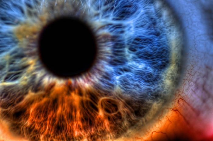 Glaukom – Sve što trebate znati o tihom kradljivcu vida