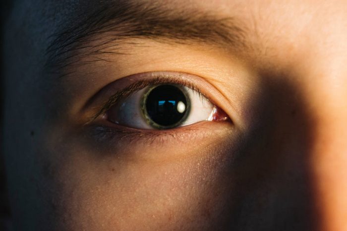 Širenje zjenica na očnom pregledu – što trebate znati?