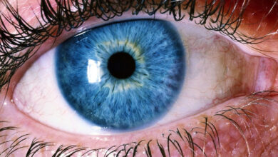 Ablacija retine, ablacija mrežnice, odvajanje mrežnice