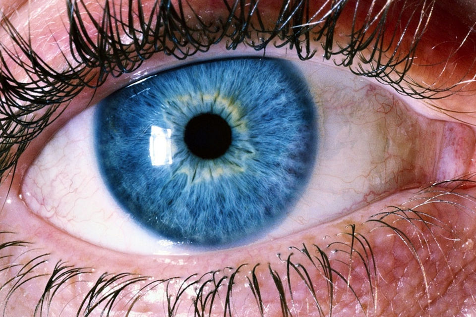 Ablacija retine, ablacija mrežnice, odvajanje mrežnice