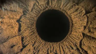 aniridija, nedostatak šarenice