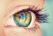 astigmatizam, astigmatizam oka