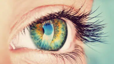 astigmatizam, astigmatizam oka