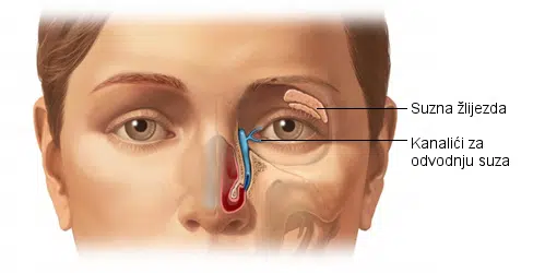 Blokirani suzni kanal simptomi, zatvoreni suzni kanali