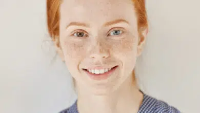 heterokromija, različita boja očiju