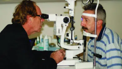 leće za keratokonus, rose k kontaktne leće, keratokonus leće