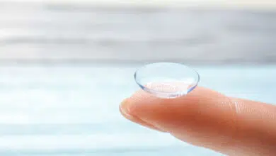 kontaktne leće alergije, alergija leće