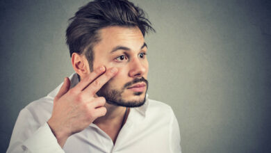 krmelji u očima, krmelji na trepavicama, krmelji