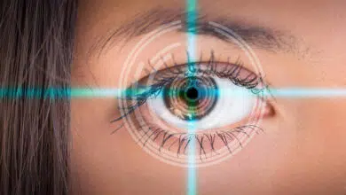 lasersko skidanje dioptrije dobna granica, kandidat za skidanje dioptrije