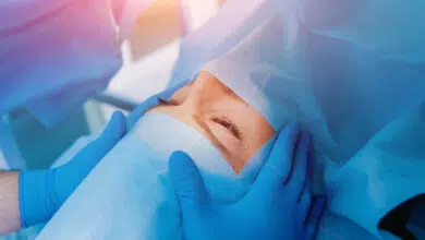 osjećaj laserskog skidanja dioptrije, skidanje dioptrije osjecaj operacije