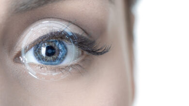 kako se obavlja LASIK zahvat, lasik zahvat skidanja dioptrije