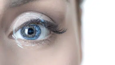 kako se obavlja LASIK zahvat, lasik zahvat skidanja dioptrije