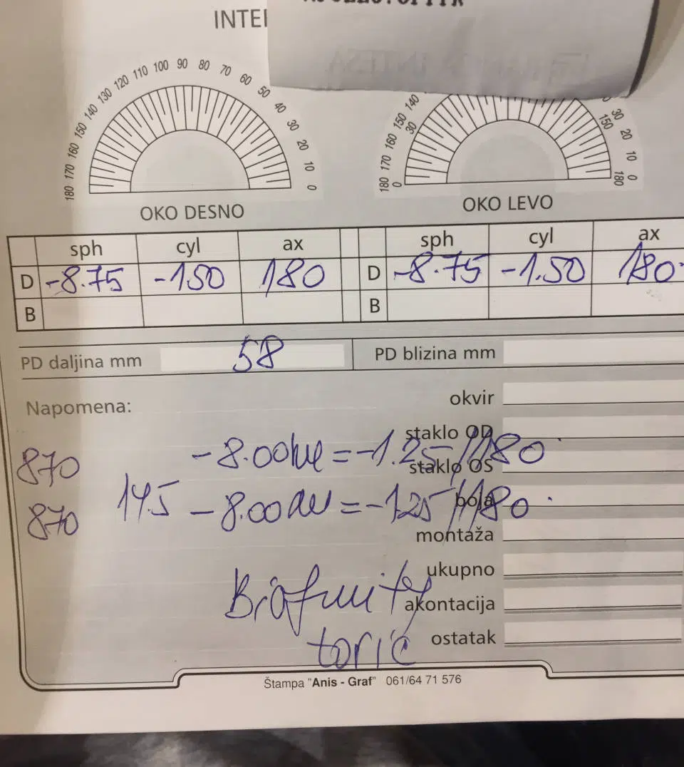 Nalaz za naočale i kontaktne leće