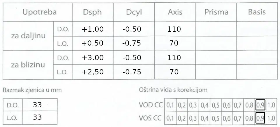 Oftalmološki nalaz dioptrija dalekovidnost, astigmatizam, presbiopija