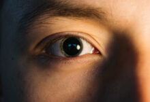 širenje zjenica, proširena zjenica