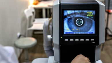 skijaskopija, određivanje dioptrije na široke zjenice