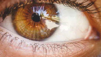 transplantacija rožnice, transplantacija rožnice oporavak, transplantacija rožnice operacija