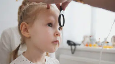 Astigmatizam kod djece