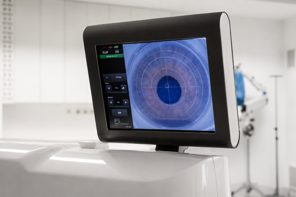 TECHNOLAS TENEO 317 Model 2 laser