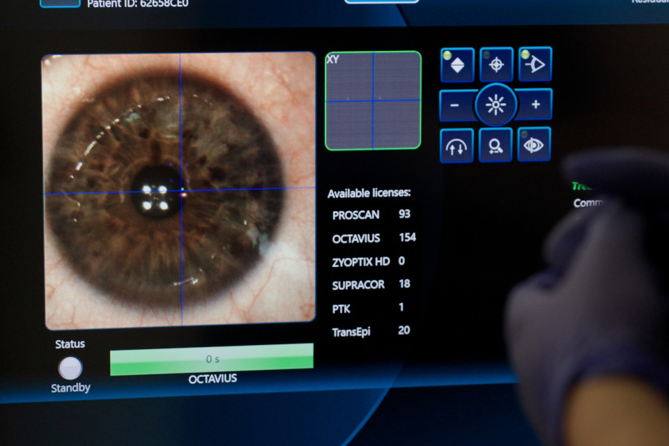 Teneo laser Optical Express